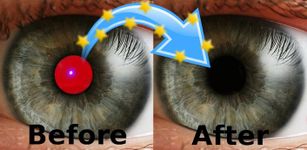 Red Eye Removal screenshot apk 