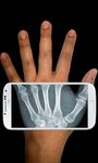 Xray Scanner Prank imgesi 3