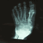 Рентгеновский сканер APK