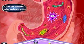 Stomach Doctor - Surgery Game image 3