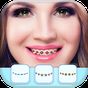 Braces App for Teeth That Look Real APK