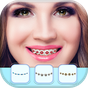 Braces App for Teeth That Look Real apk icon