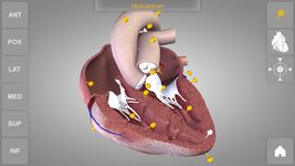 Heart 3D Anatomy Lite ảnh số 8