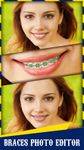 Imagem 2 do Aparelho dental