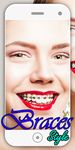 Gambar braces camera & braces Teeth photo editor 2