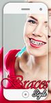 Gambar braces camera & braces Teeth photo editor 7