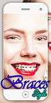 Gambar braces camera & braces Teeth photo editor 10