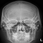 APK-иконка Human X-ray Anatomy