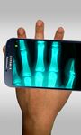 Xray Scanner Prank imgesi 2