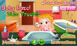 Baby Hazel Skin Trouble imgesi 