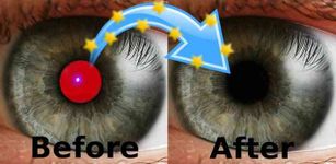 Immagine 5 di Red Eye Removal (Free)