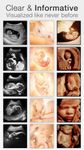 Pregnancy ++ image 10