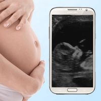 Ultraschall Schwangerschaft St APK Icon