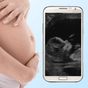 Ikon apk USG kehamilan prank
