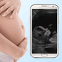 Icône apk Ultrasound Pregnancy Prank