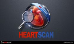 Heart Scan ( X-Ray ) imgesi 2