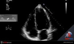 Heart Scan ( X-Ray ) imgesi 5