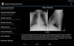 Heart Sounds & Murmurs image 