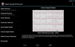 Heart Sounds & Murmurs image 1