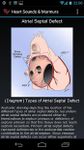 Heart Sounds & Murmurs image 4