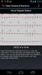 Heart Sounds & Murmurs image 5