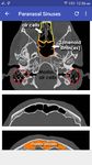 CT Scan Cross Sectional Anatomy imgesi 6