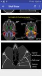 Gambar CT Scan Cross Sectional Anatomy 5