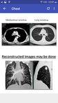 Gambar CT Scan Cross Sectional Anatomy 4