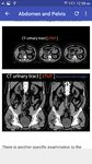 CT Scan Cross Sectional Anatomy image 3