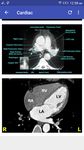 Gambar CT Scan Cross Sectional Anatomy 