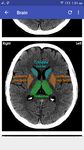 CT Scan Cross Sectional Anatomy image 1