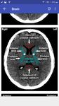 Gambar CT Scan Cross Sectional Anatomy 2