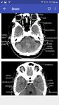 Gambar CT Scan Cross Sectional Anatomy 15