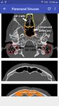 CT Scan Cross Sectional Anatomy image 14