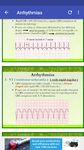 A to Z ECG Interpretation afbeelding 1