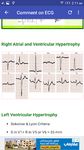 A to Z ECG Interpretation ảnh số 12