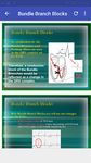 A to Z ECG Interpretation ảnh số 13