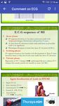 A to Z ECG Interpretation afbeelding 7