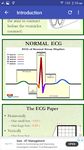 Immagine 3 di A to Z ECG Interpretation