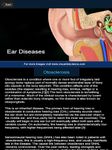 My Ear Anatomy image 