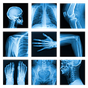 Medical X-Ray Interpretation with 100+ Cases APK