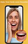 Braces Photo Editor 2019 afbeelding 1