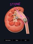 Captură de ecran My Urinary System apk 1