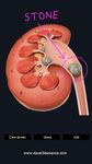 Captură de ecran My Urinary System apk 9