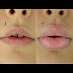 Large Lips (Guide) image 1