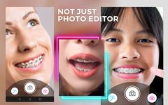 Behel Camera Beauty Brace captura de pantalla apk 1