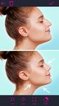 Rhinoplasty & Lips Editor screenshot apk 20