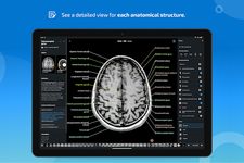 ภาพหน้าจอที่ 11 ของ e-Anatomy