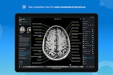 e-Anatomy のスクリーンショットapk 2