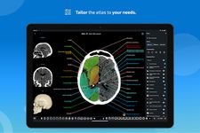 e-Anatomy のスクリーンショットapk 1